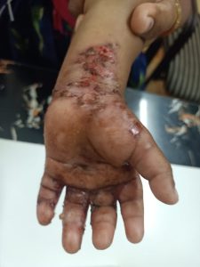 # dr paiyanka mandal treatment care's